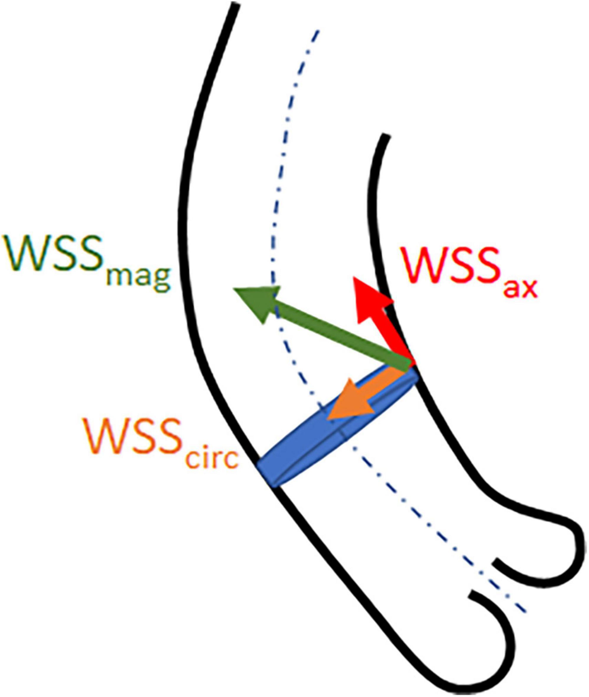 4D-flow MRI derived wall shear stress for the risk stratification of bicuspid aortic valve aortopathy: A systematic review